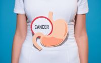 胃癌诱因重新排名，“肥胖”挤进前三名！