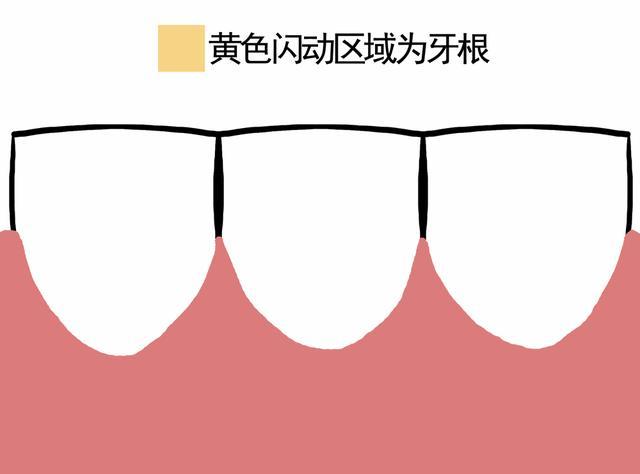 牙齿健康警示：频繁塞牙可能是你的牙在喊救命