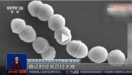 揭秘日本食人菌：致命感染与手脚坏死风险 第1张
